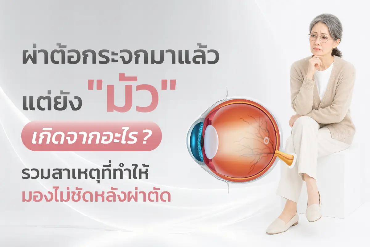  ผ่าต้อกระจกมาแล้วแต่ยังมัว